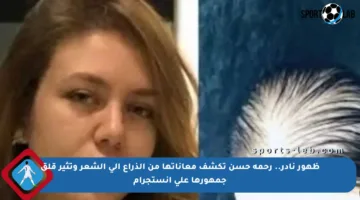 ظهور نادر.. رحمة حسن تكشف معاناتها من الذراع إلى الشعر وتثير قلق جمهورها على إنستجرام